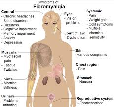 Lesspacuthong Fibromyalgia Pressure Points Diagram