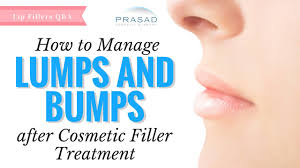 lumps from cosmetic fillers