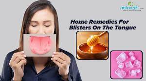 tongue blisters 7 effective home