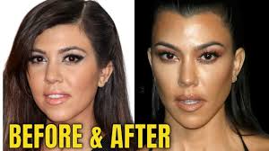 kourtney kardashian plastic surgery