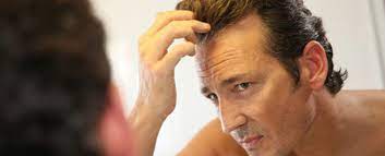 can rogaine minoxidil make hair loss