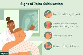 Subluxation And Joint Dislocation