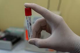 covid rapid tests coronavirus uc