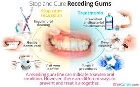 stop and cure reciding gums shecares