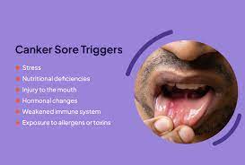 canker sore causes and risk factors