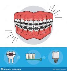Dental Braces Elements Stock Vector Illustration Of Beauty