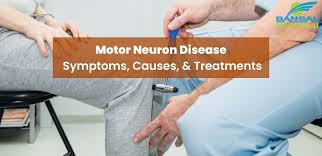 motor neuron disease symptoms causes