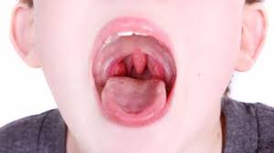 sore throat swollen lymph nodes in the