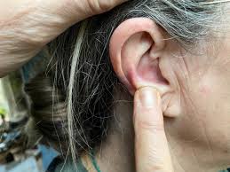 pimple in ear causes and how to get