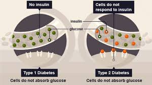 stem cell therapy for diabetes mellitus