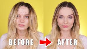 acne coverage back to makeup