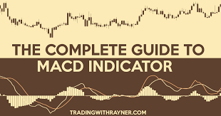 The Complete Guide To Macd Indicator