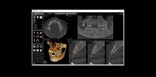 dr salib offers cone beam ct scanner