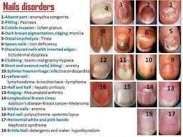 what are nail abnormalities clues to