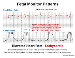 Diagram Of A Fetal Heart Wiring Diagrams Folder