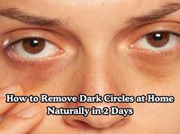 how to remove dark circles at home