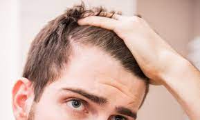solutions hair restoration and wellness