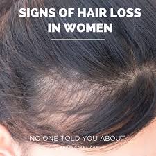 Different hair loss patterns in men and women. Causes Of Hair Loss In Women Shopno Dana