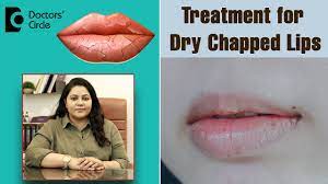 heal chapped lips fast with these 4
