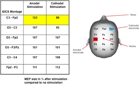 Electrode Positioning In Transcranial Direct Current