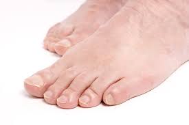 could that ache in your big toe be gout