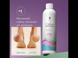 amazon best selling best callus remover