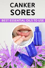 best essential oils for canker sores