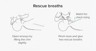 Its an emergency procedure performed in an effort to manually preserve intact brain function until further measures are taken to restore spontaneous. How To Perform Cpr Guidelines Procedure And Ratio