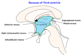 third ventricle anatomy qa
