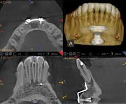 invest in the right cbct solution for