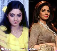 bollywood plastic surgeries disasters