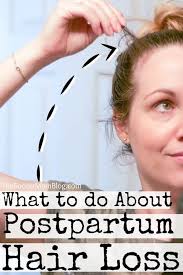 postpartum hair loss how to deal the