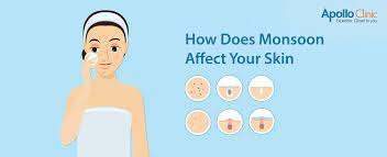 how does monsoon affect your skin
