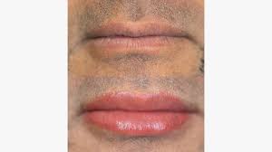 lip blushing tattoo procedure benefits