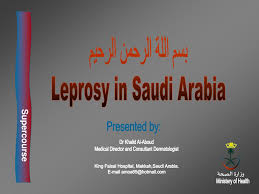 Usa company executive email address. Ppt Ø¨Ø³Ù… Ø§Ù„Ù„Ø© Ø§Ù„Ø±Ø­Ù…Ù† Ø§Ù„Ø±Ø­ÙŠÙ… Leprosy In Saudi Arabia Powerpoint Presentation Id 510711