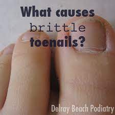 what causes brittle toenails delray