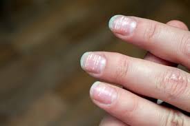 white spots on fingernails here s what