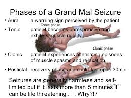 I suppose this also works for hypnosismore. Grand Mal Seizure Mri Seizures Nursing Seizures Paramedic School