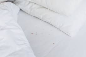 how to identify and clean bed bug stains
