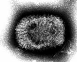 Dsdna viruses, no rna stage; Orthopoxvirus Alchetron The Free Social Encyclopedia