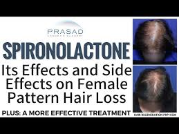 female pattern hair loss and kidneys