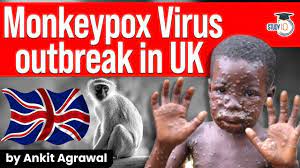However, a virus from the same family, monkeypox, has been reported in a handful of places, with two cases recently found in north wales in the united kingdom. Monkeypox Virus Outbreak In Uk Signs And Symptoms Of Monkeypox Current Affairs For Upsc Exam Youtube