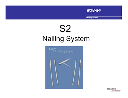 nailing system