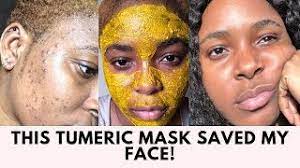 tumeric mask that cleared my acne scars