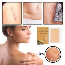 6pcs invisible tattoo scar acne cover