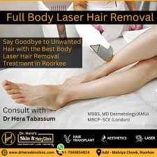 full body laser hair removal
