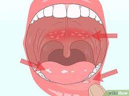prevent dry mouth while sleeping wikihow