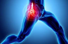 hip replacement surgery reasons type