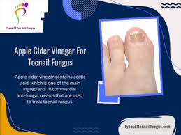 apple cider vinegar for toenail fungus