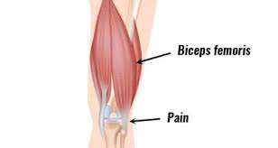 lateral knee pain outside of the knee